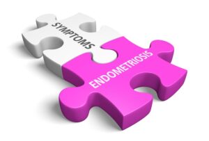 endometriosis